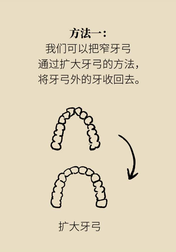 "龅牙"矫正不可盲目,四类嘴突类型要对症下药! - 小科普